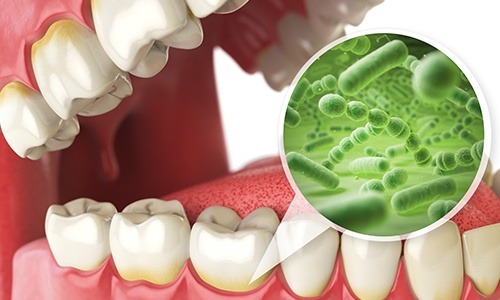 Animation of smile and bacteria