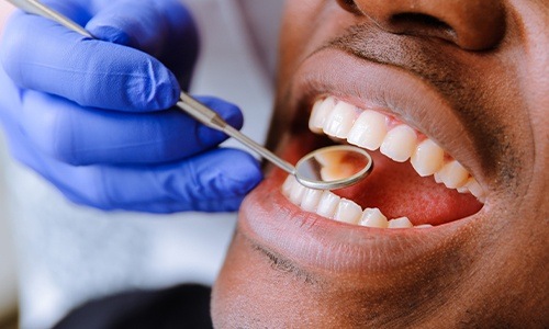 Closeup of smile during dental exam