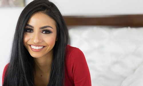 Woman with proportioned teeth after gum recontouring