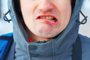 Man with winter mouth issues should see Worcester dentist