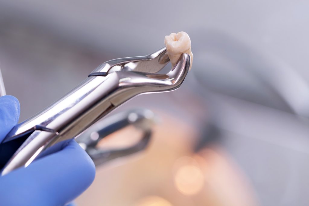 Closeup of dental tool holding extracted tooth