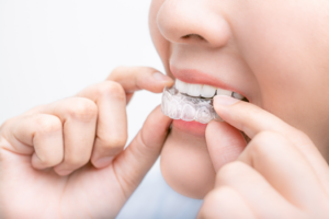 an Invisalign patient wearing her aligner